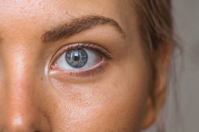 eczema adult